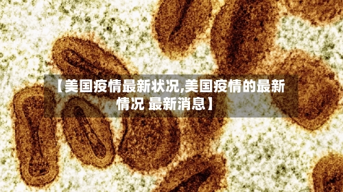 【美国疫情最新状况,美国疫情的最新情况 最新消息】-第2张图片