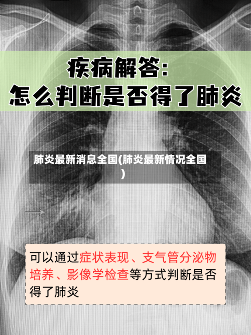 肺炎最新消息全国(肺炎最新情况全国)-第2张图片
