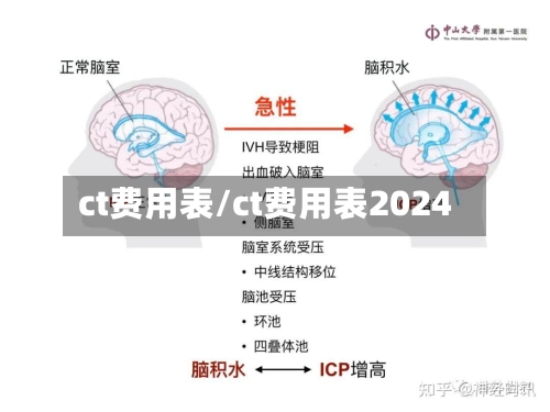 ct费用表/ct费用表2024