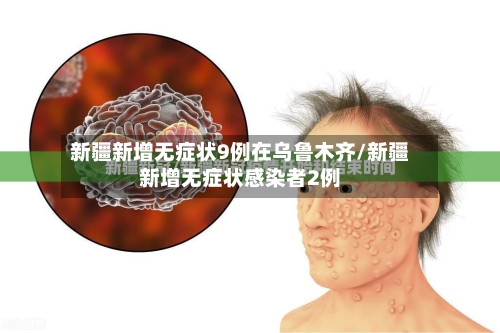 新疆新增无症状9例在乌鲁木齐/新疆新增无症状感染者2例-第3张图片